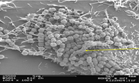 Streptococcus salivarius k12 (BLIS K12)